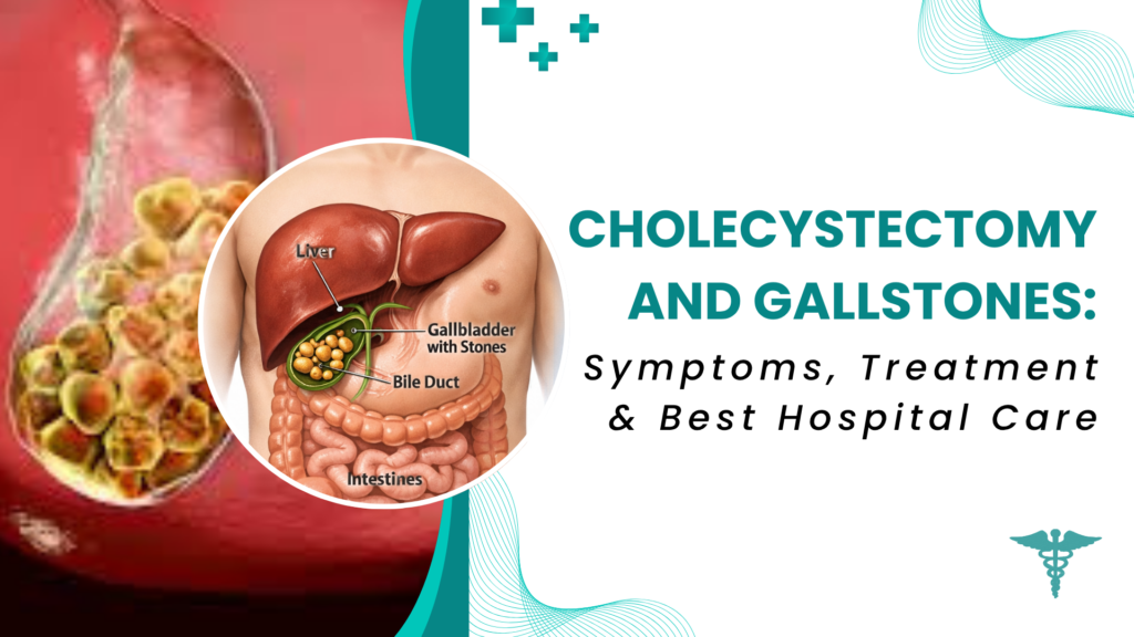 Cholecystectomy and gallstones infographic showing gallbladder with stones, symptoms, and treatment overview.
