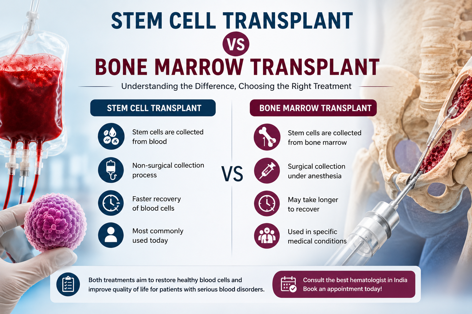 Infographic comparing stem cell transplant and bone marrow transplant, showing differences in stem cell source, collection method, recovery time, and treatment purpose.